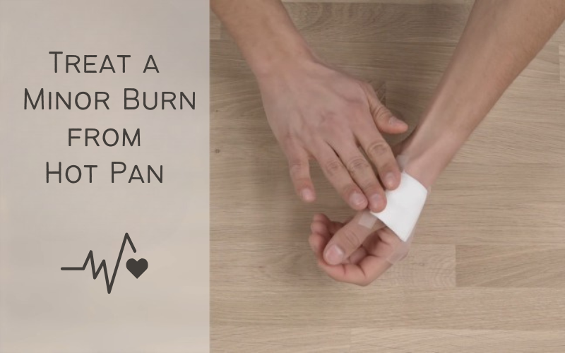 How to Treat a Minor Burn from a Hot Pan