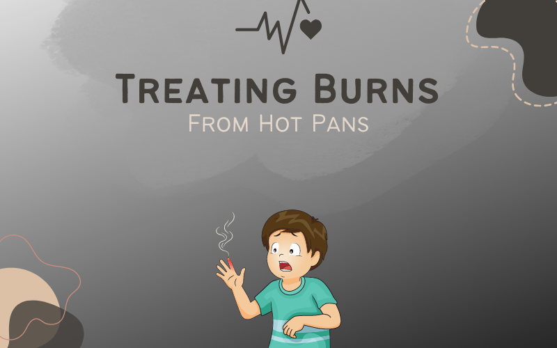 Treating Burns From Hot Pans